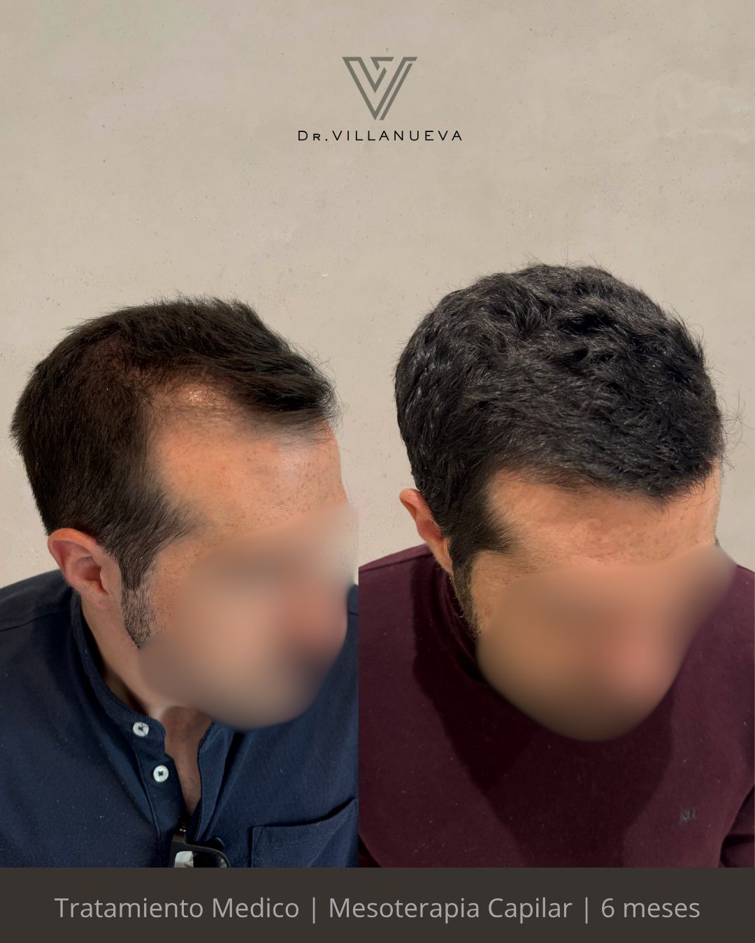 Alfredo Villanueva-11