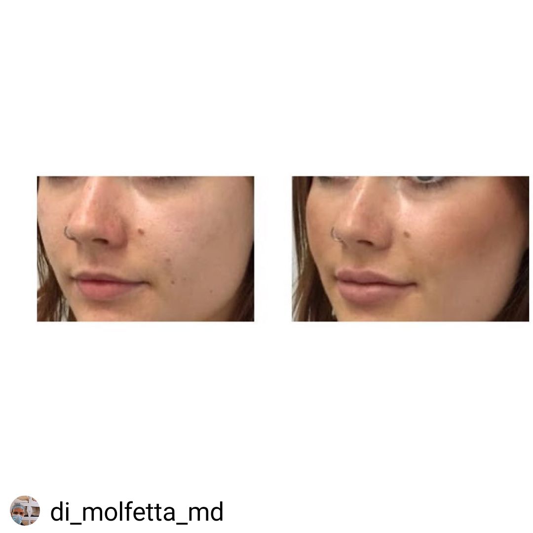 Pasquale Di Molfetta-14