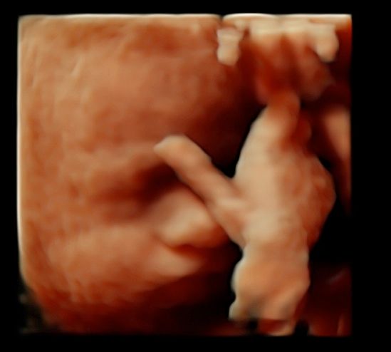 Tommaso Incandela-59