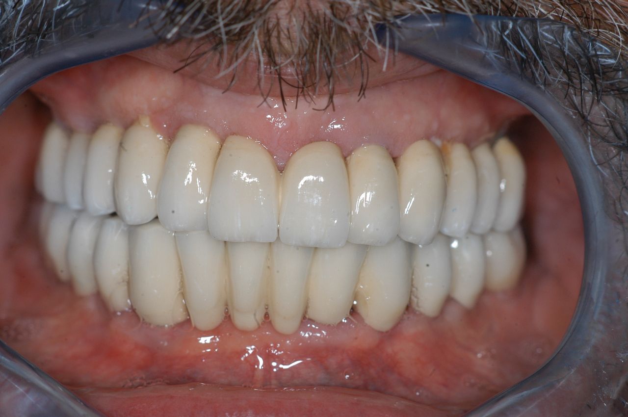 Alessandro Palumbo-25