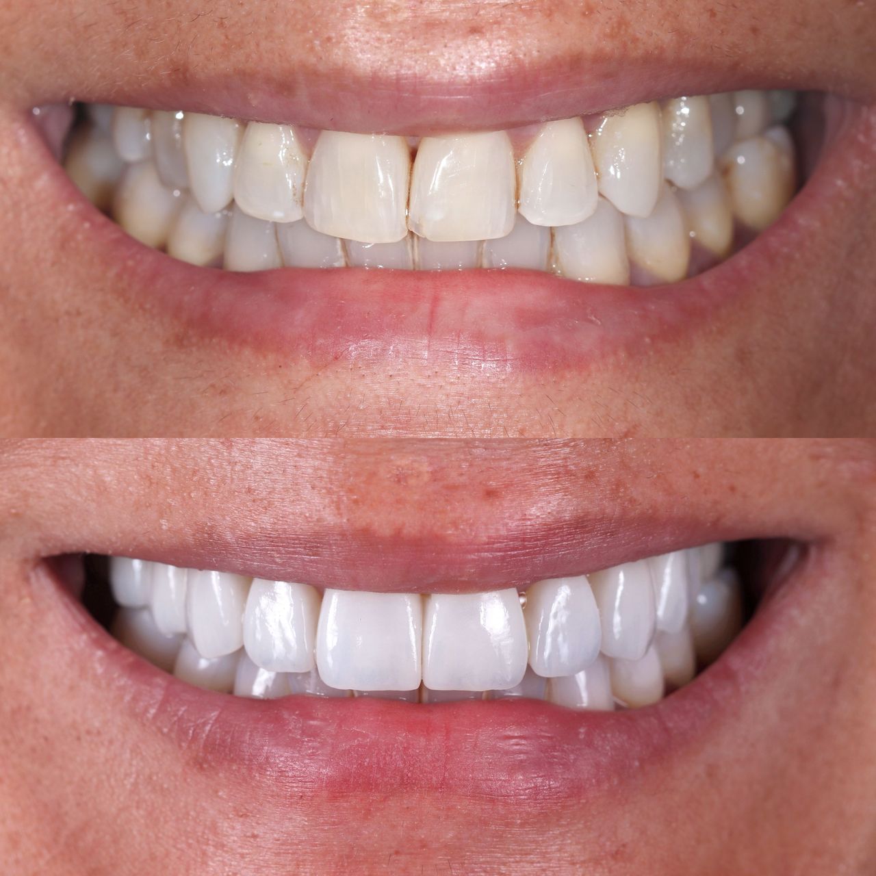 Patricia Bosquet Narros-8