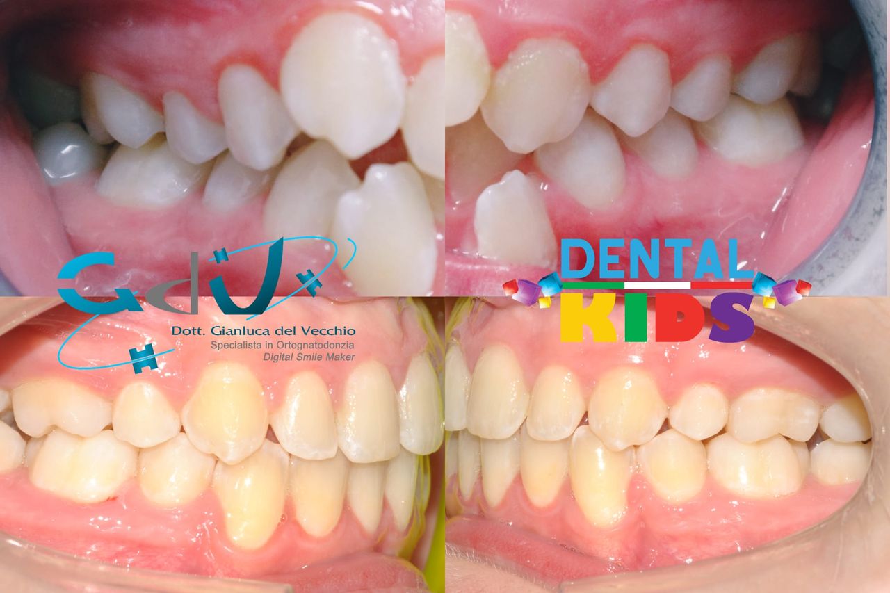 Gianluca Del Vecchio-176