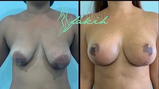 Ibrahim Fakih Gómez-15