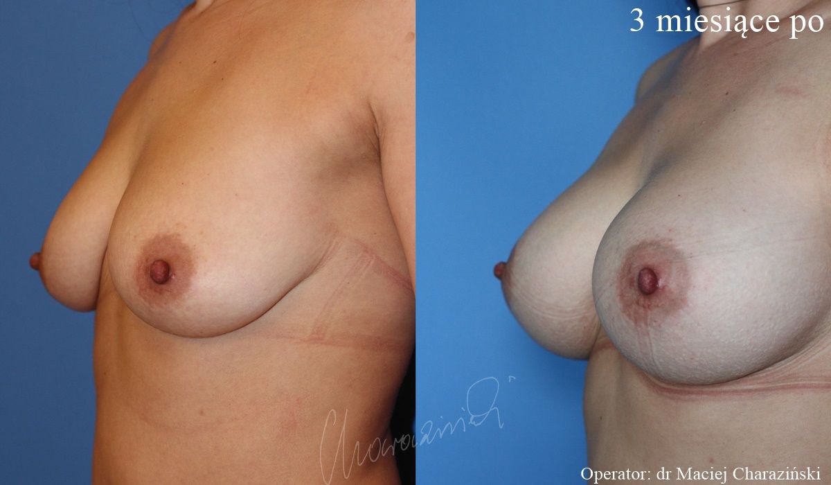 Maciej Charaziński-107