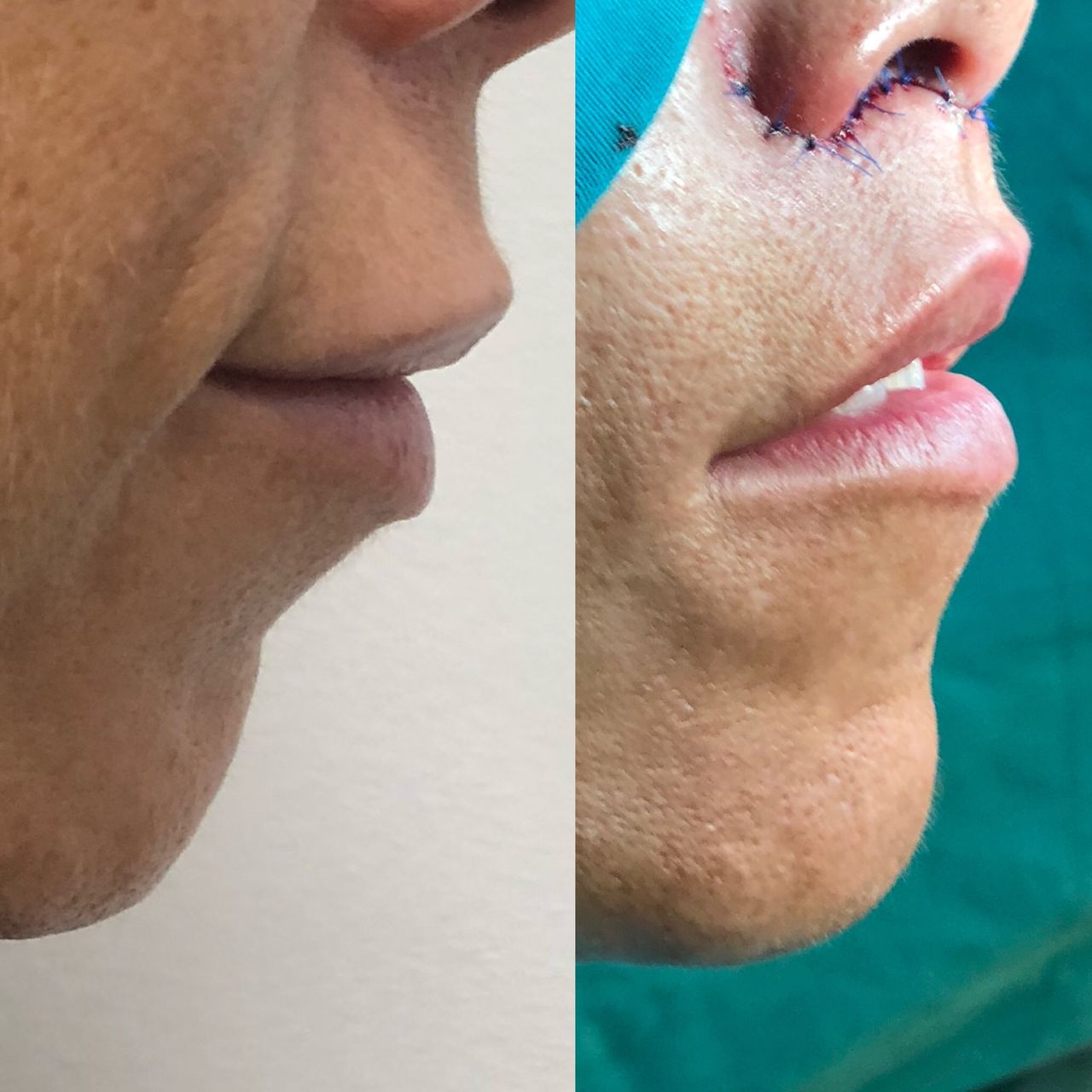 Alberto Candau Álvarez-34