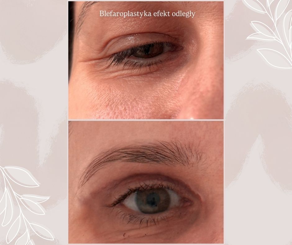 Piotr Florczuk-Dąbek-6