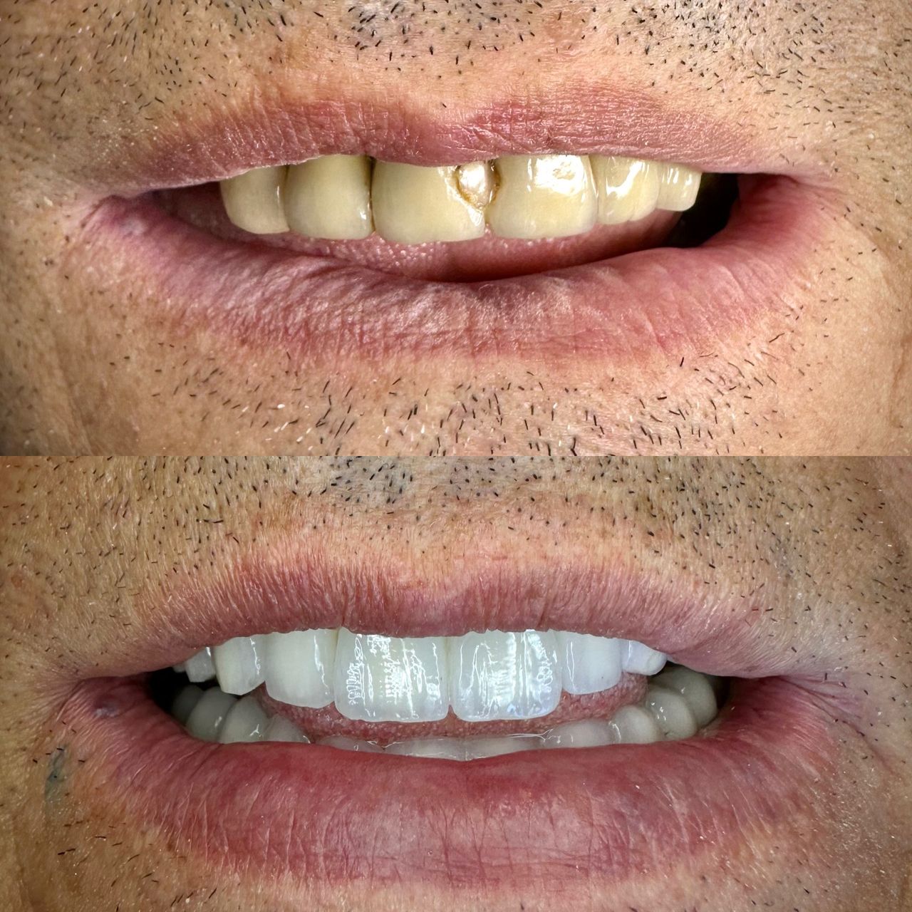 Annibale Donnarumma-2