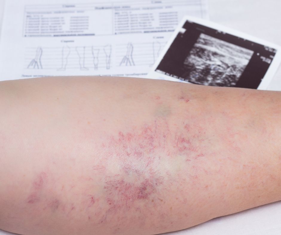 Marek Szkiłłądź-2