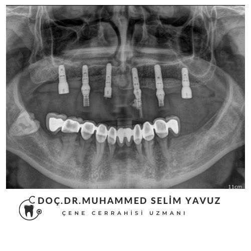 Muhammed Selim Yavuz-10