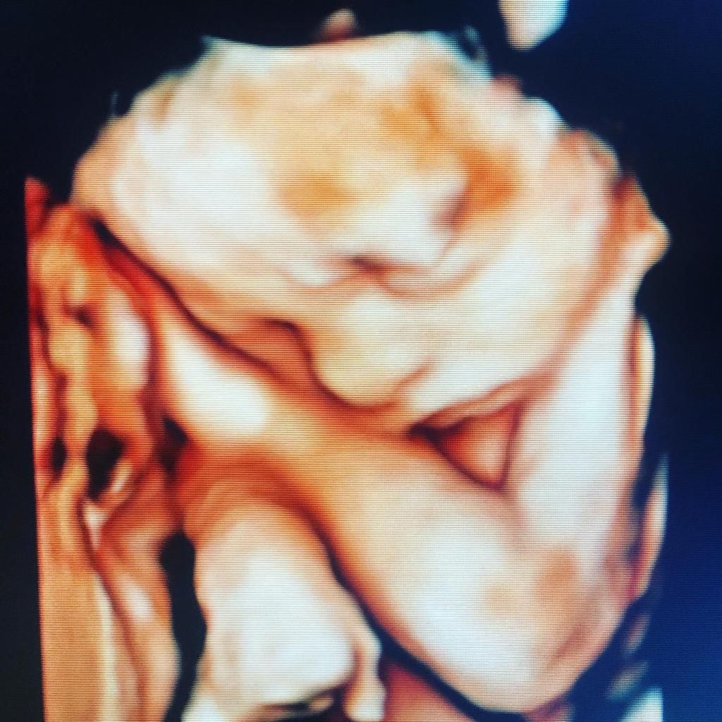 Dilek Turğut Kestane-15