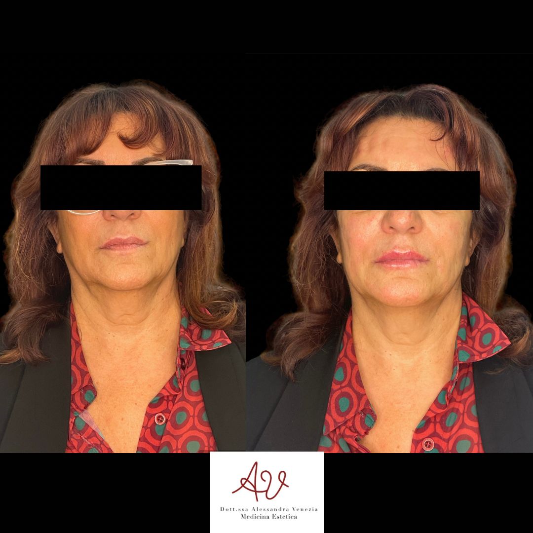 Alessandra Venezia-11