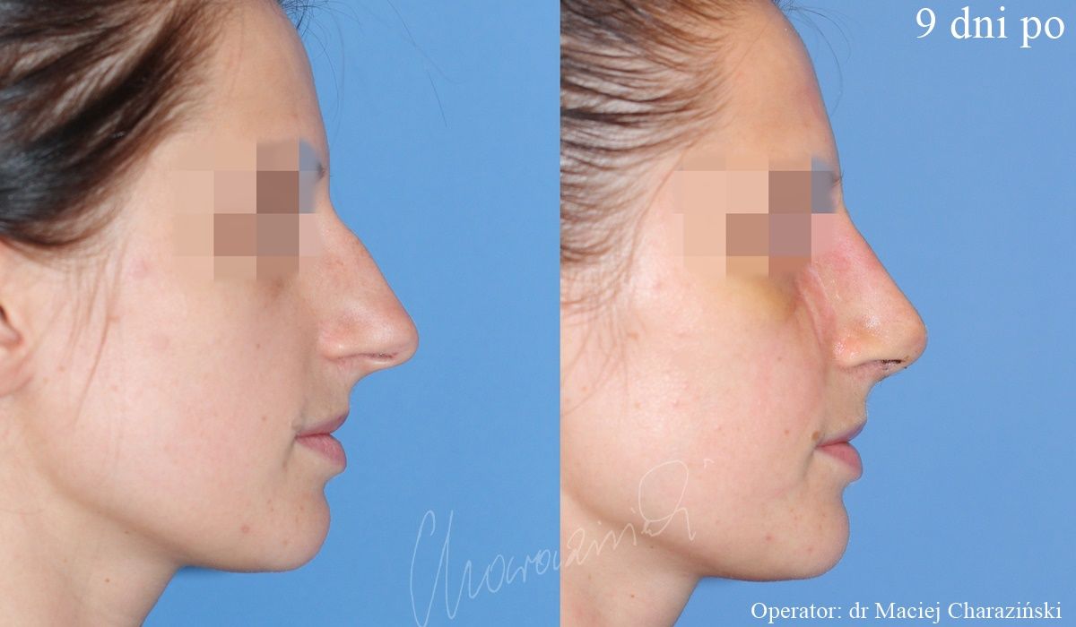 Maciej Charaziński-24