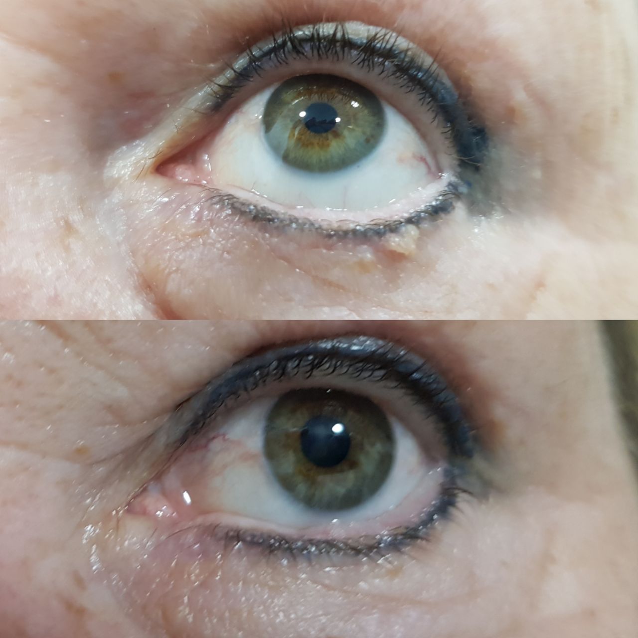 Rosalba Herrero Zerpa-222