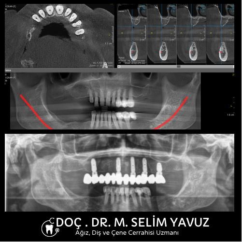 Muhammed Selim Yavuz-16