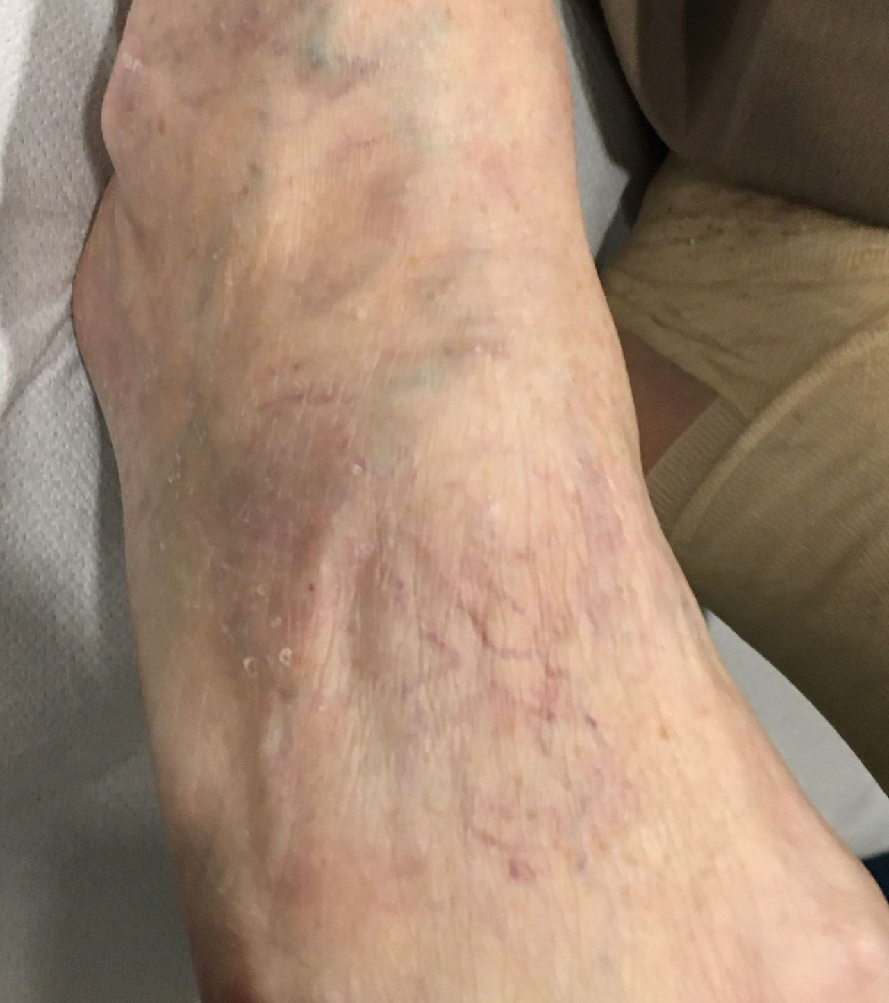 Arnaldo Strazzaboschi-11