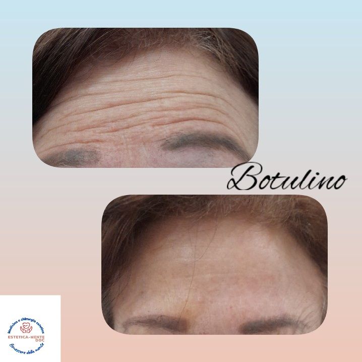 Paola Della Rocca-60