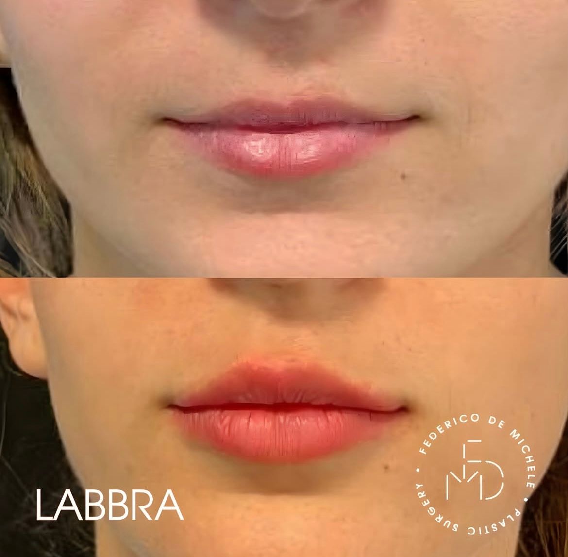 Federico De Michele-7