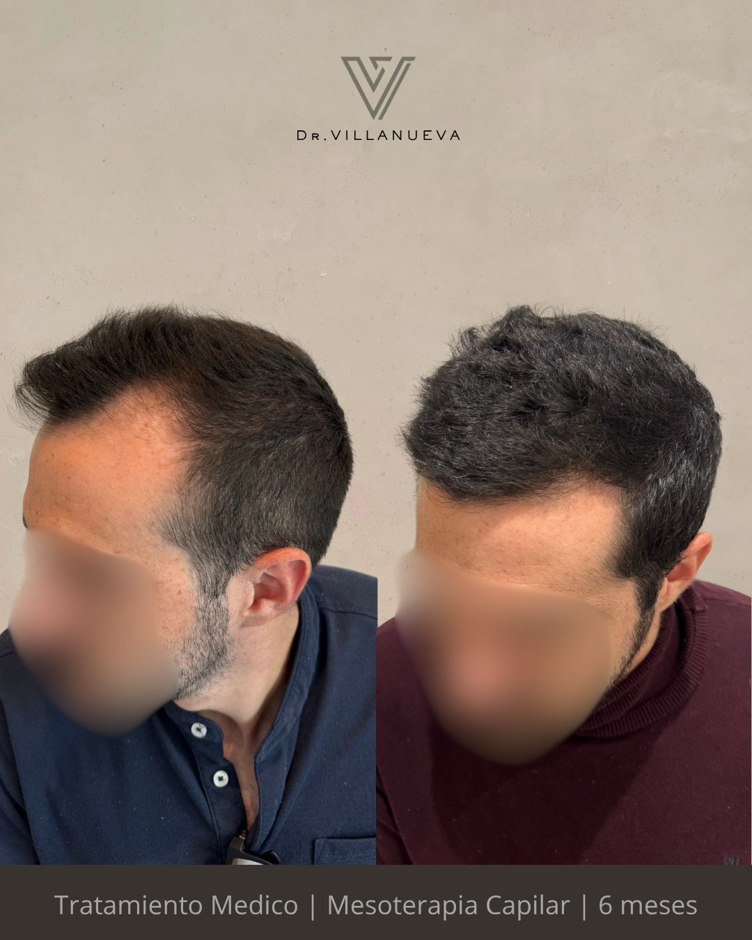 Alfredo Villanueva-12