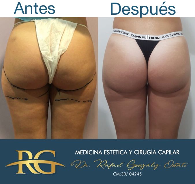 Rafael Gonzalez Oñate-9