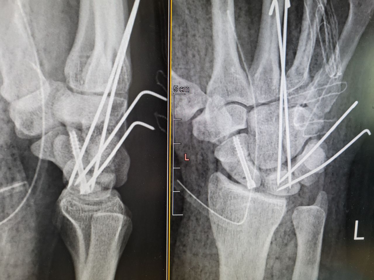 Mateusz Orzechowski-5