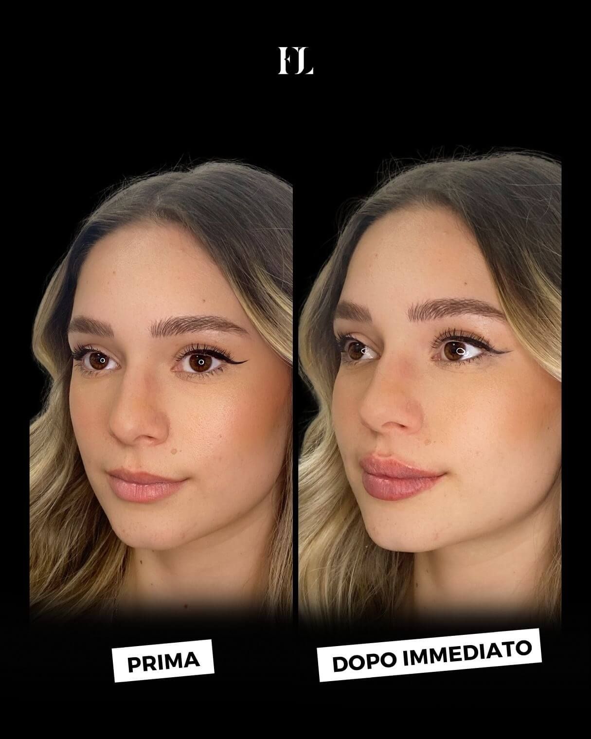 Floriana Lauritano-37