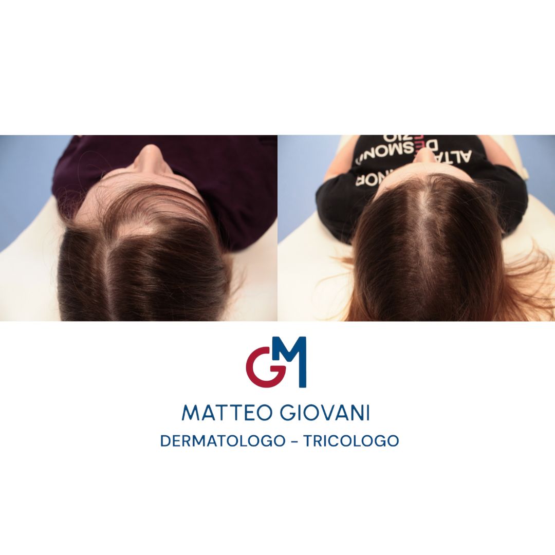 Matteo Giovani-8