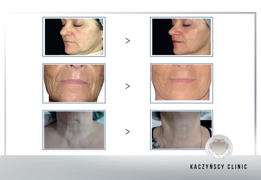 Krzysztof Jacek Kaczyński-26