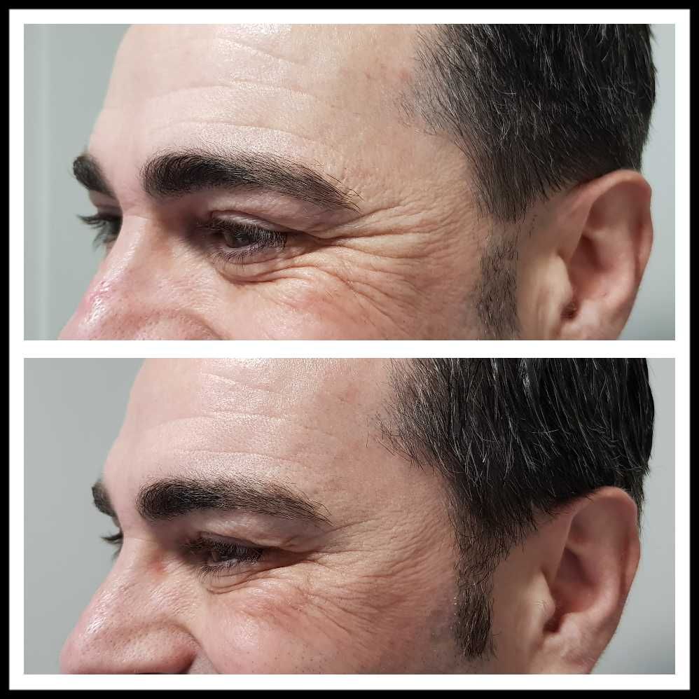 Rosalba Herrero Zerpa-378