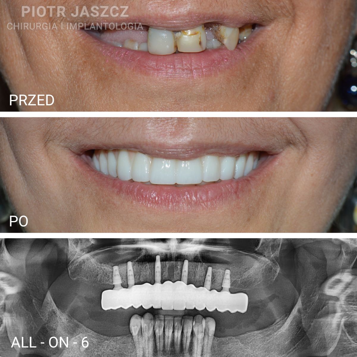 Piotr Jaszcz-1