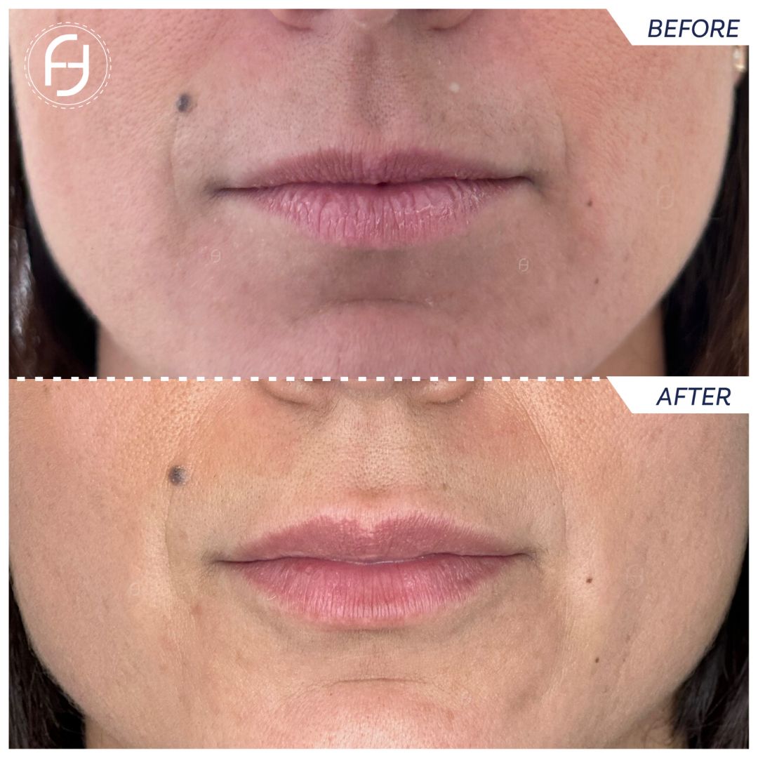 Francesca Flagiello-44