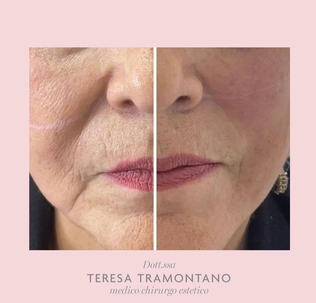 Teresa Tramontano-10