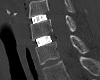 Alessandro Borderi-22