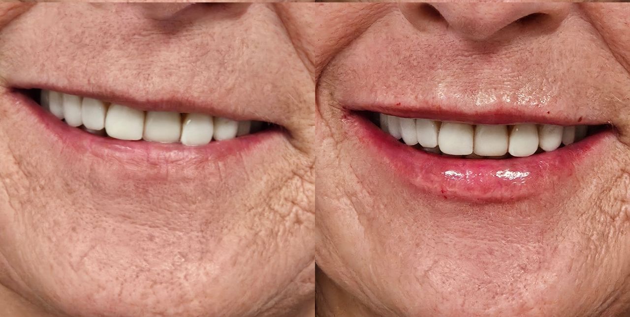 Rosalba Herrero Zerpa-570