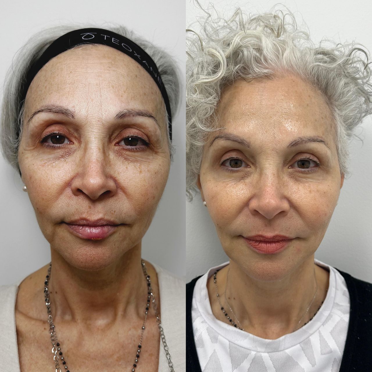 Yamel Giangreco Abchi-5