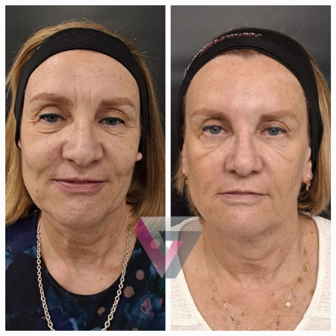 Victoria Trasmonte-129