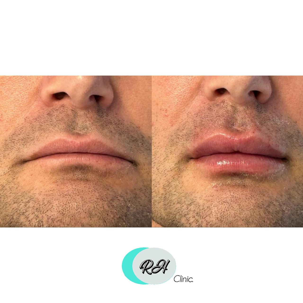 Rosalba Herrero Zerpa-109