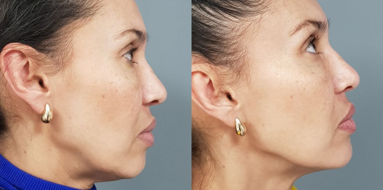 Rosalba Herrero Zerpa-483