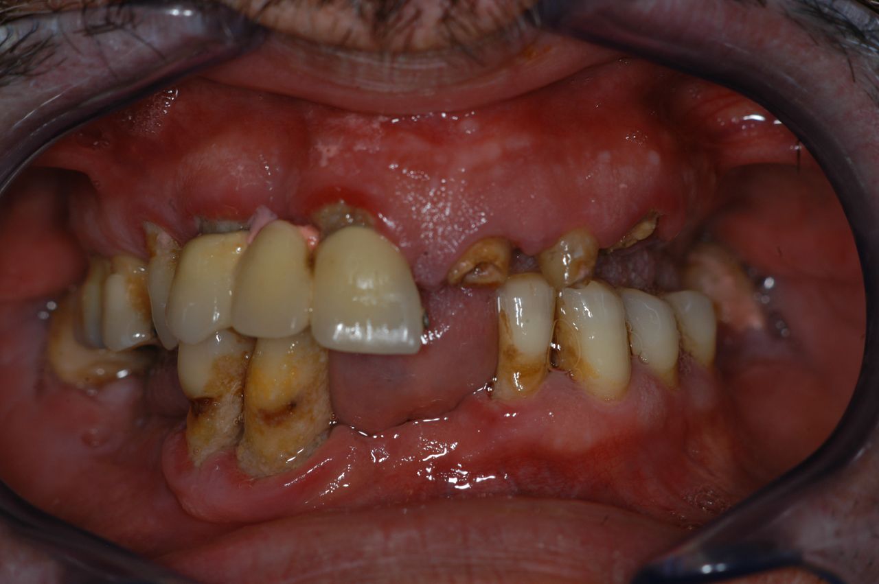 Alessandro Palumbo-23