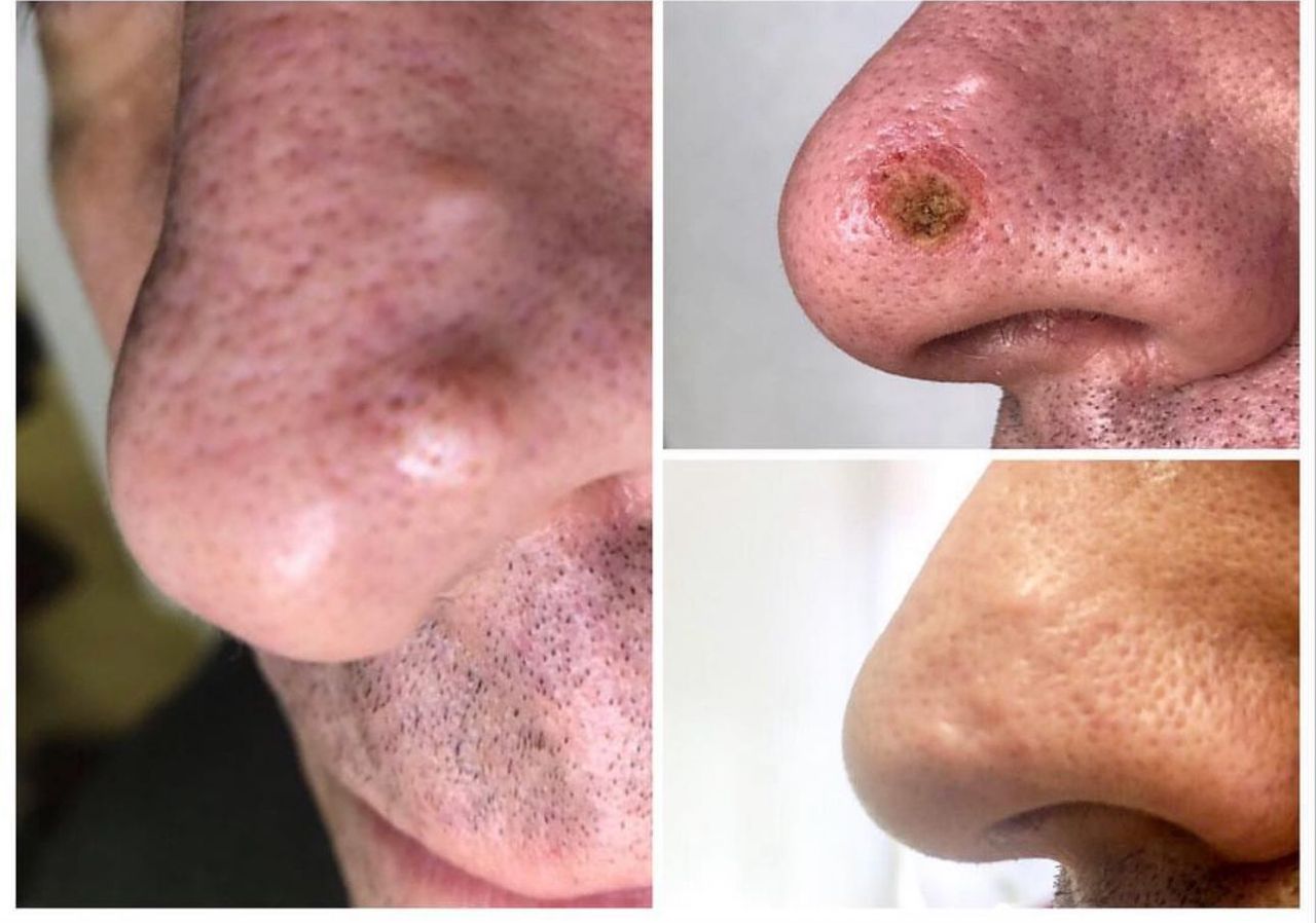 Angelo De Cataldis-5