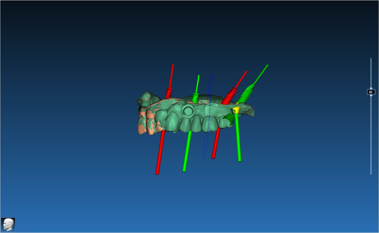 Giovanni Wiel Marin-3