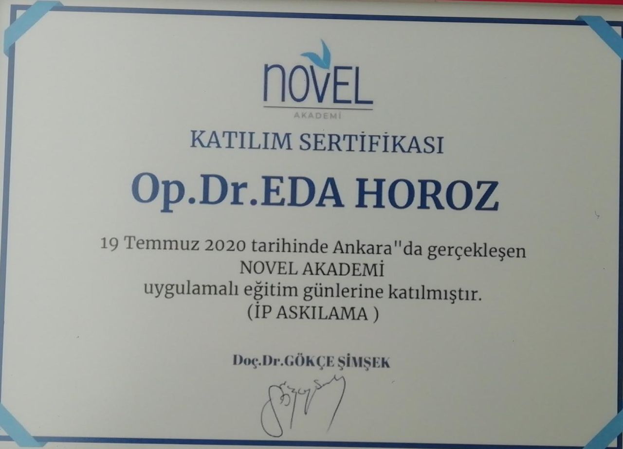 Eda Çabuk Horoz-27