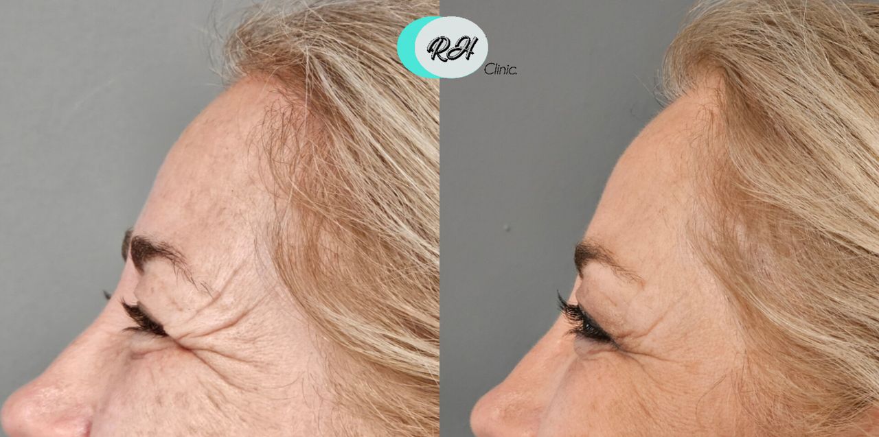 Rosalba Herrero Zerpa-601