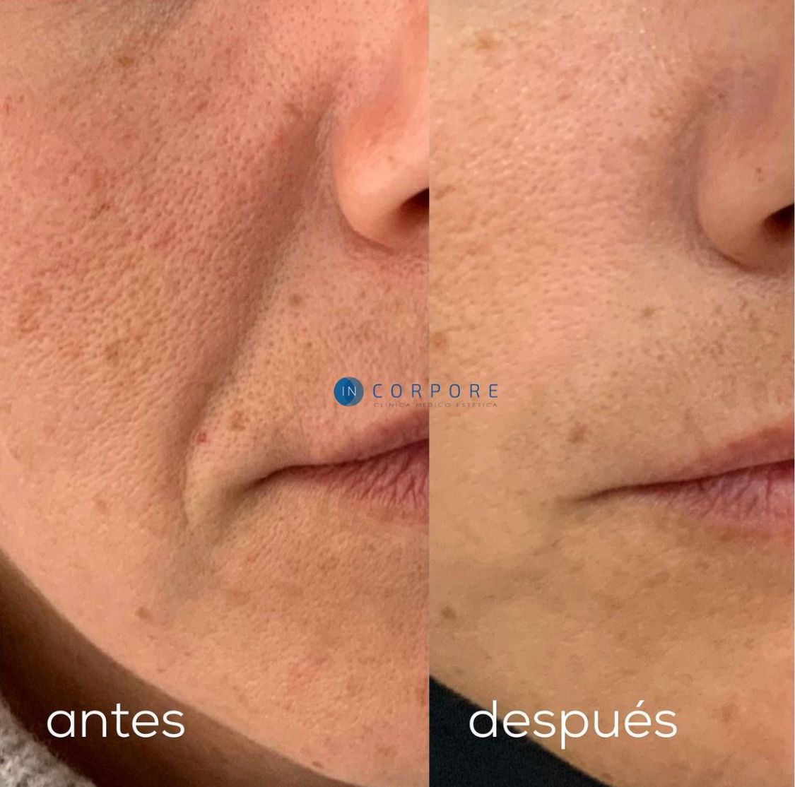 Juan Enrique Pérez Enríquez-6