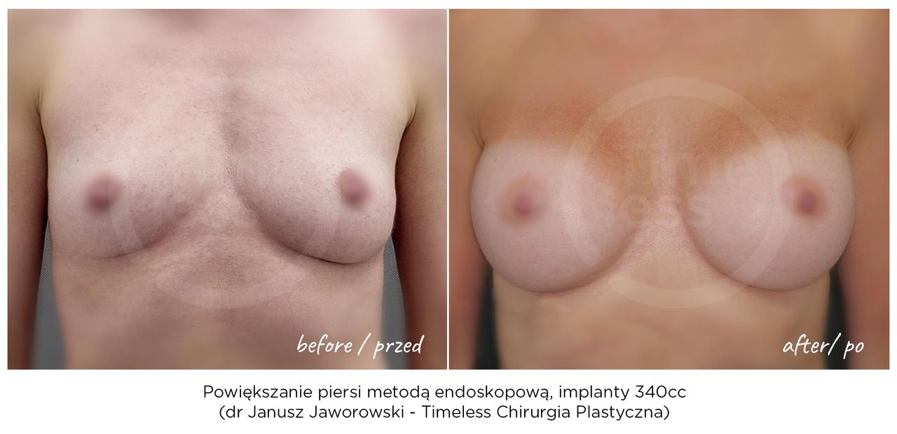 Janusz Jaworowski-170