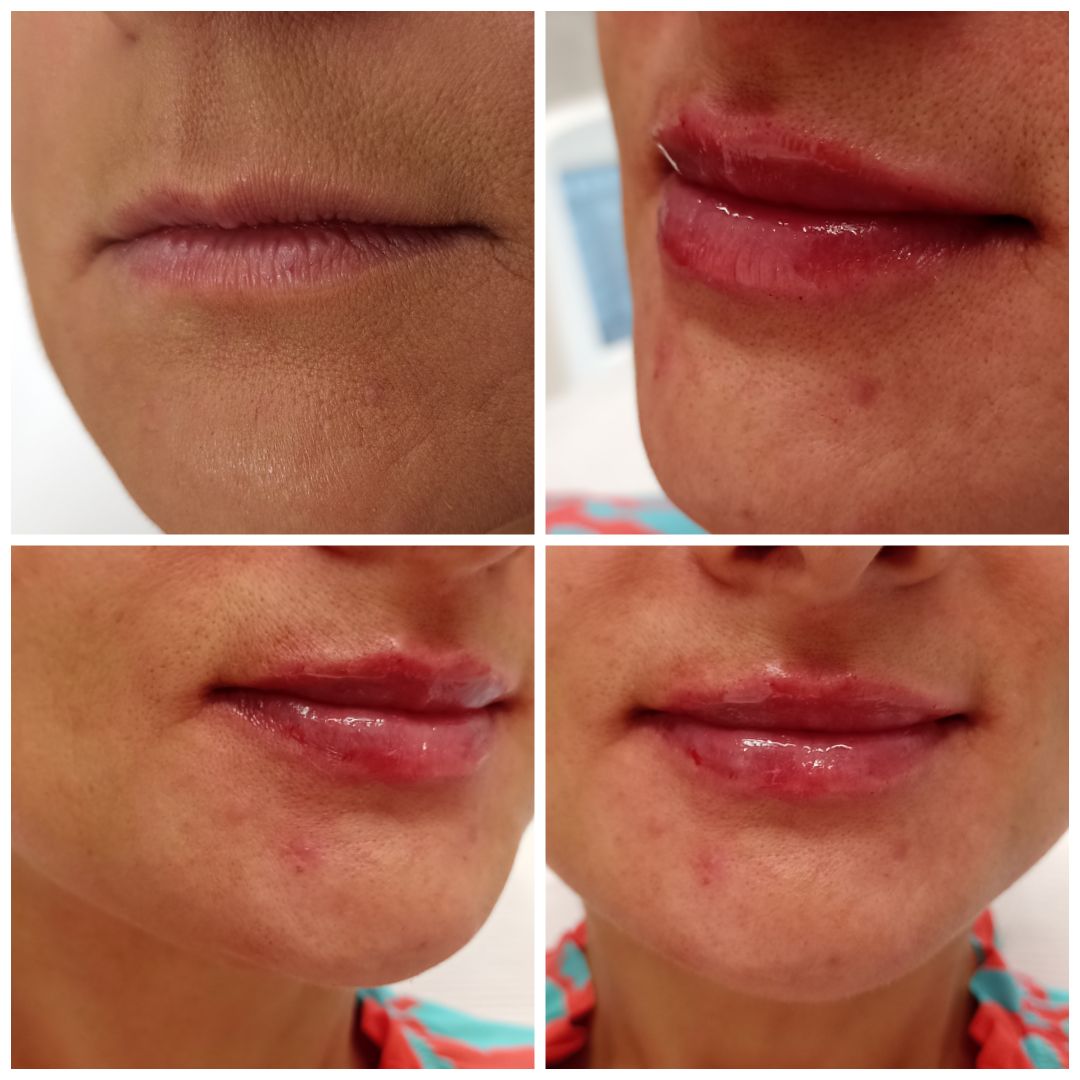 Michalina Zagańczyk-Bączek-1