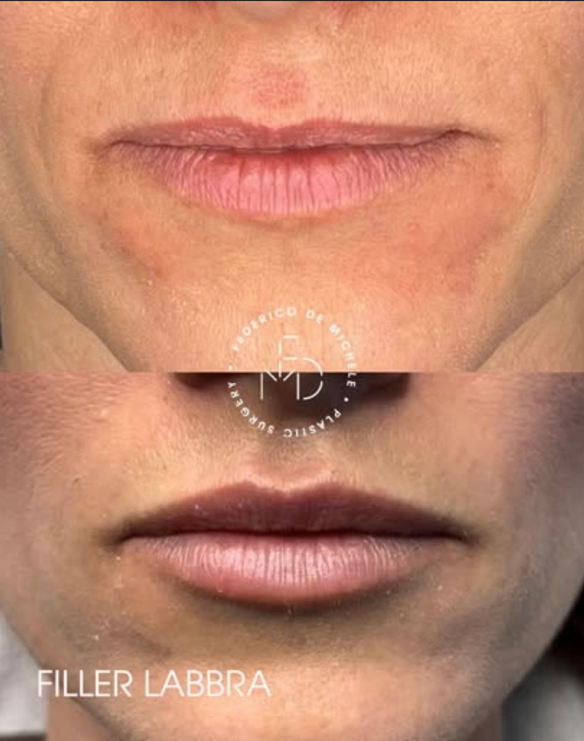 Federico De Michele-3