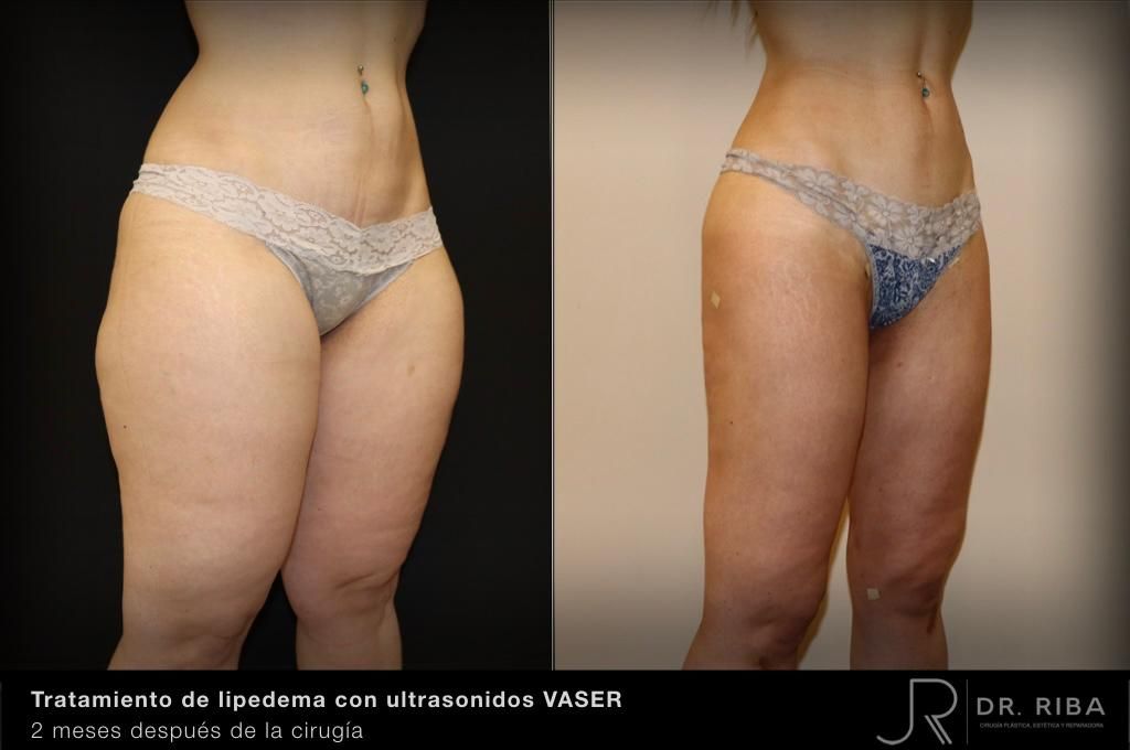 Jordi Riba Vilchez-20