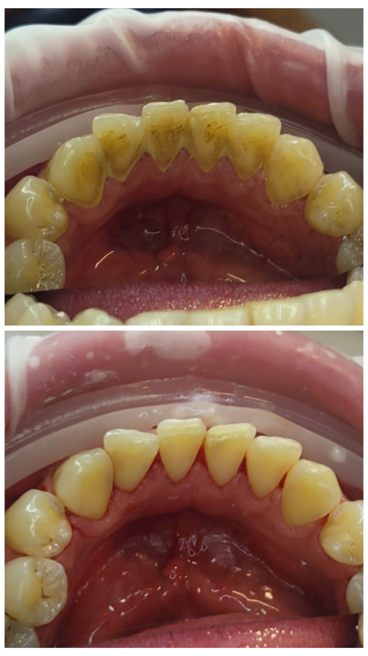 Damian Benbenkowski-4