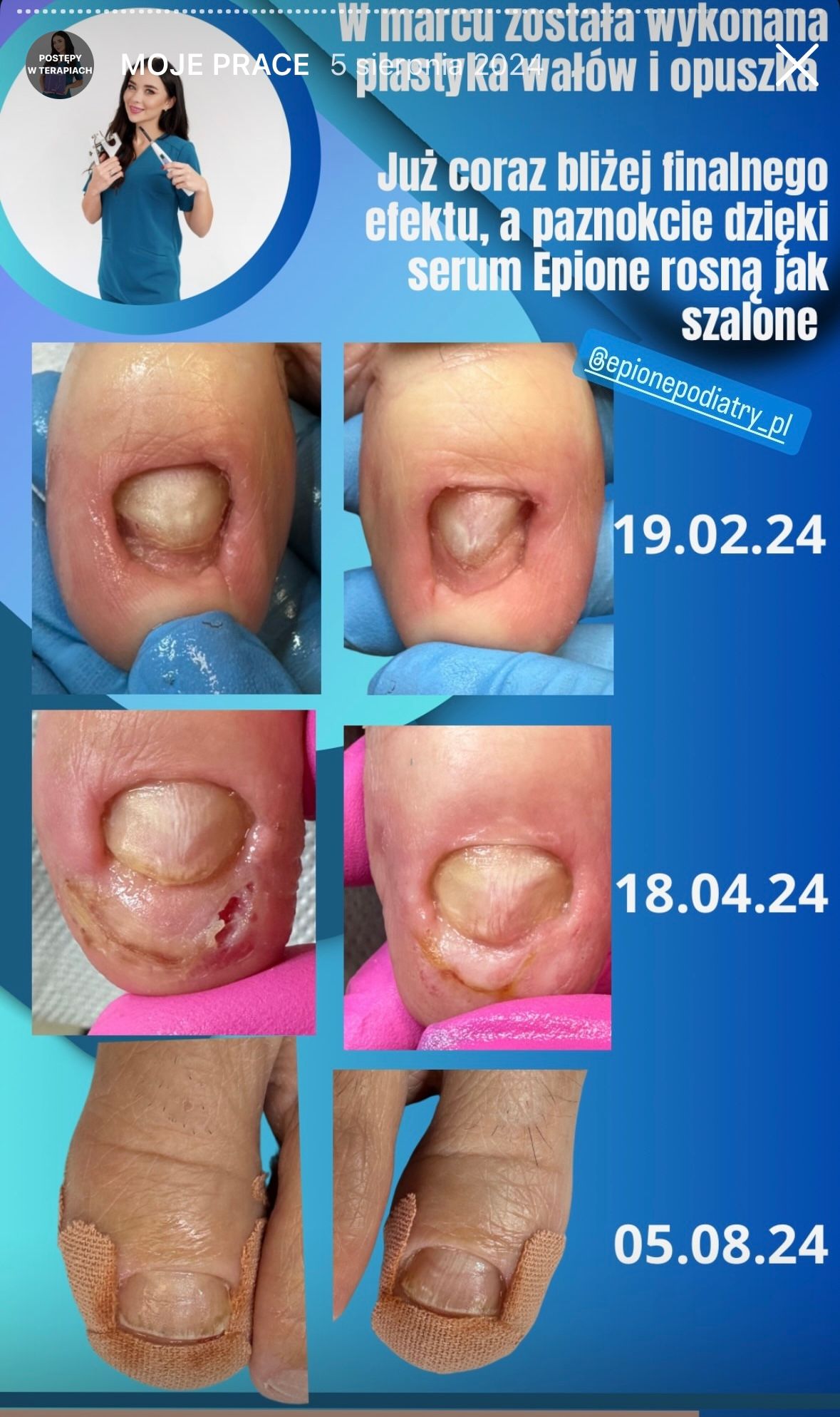 Karolina Colonna-Walewska-11