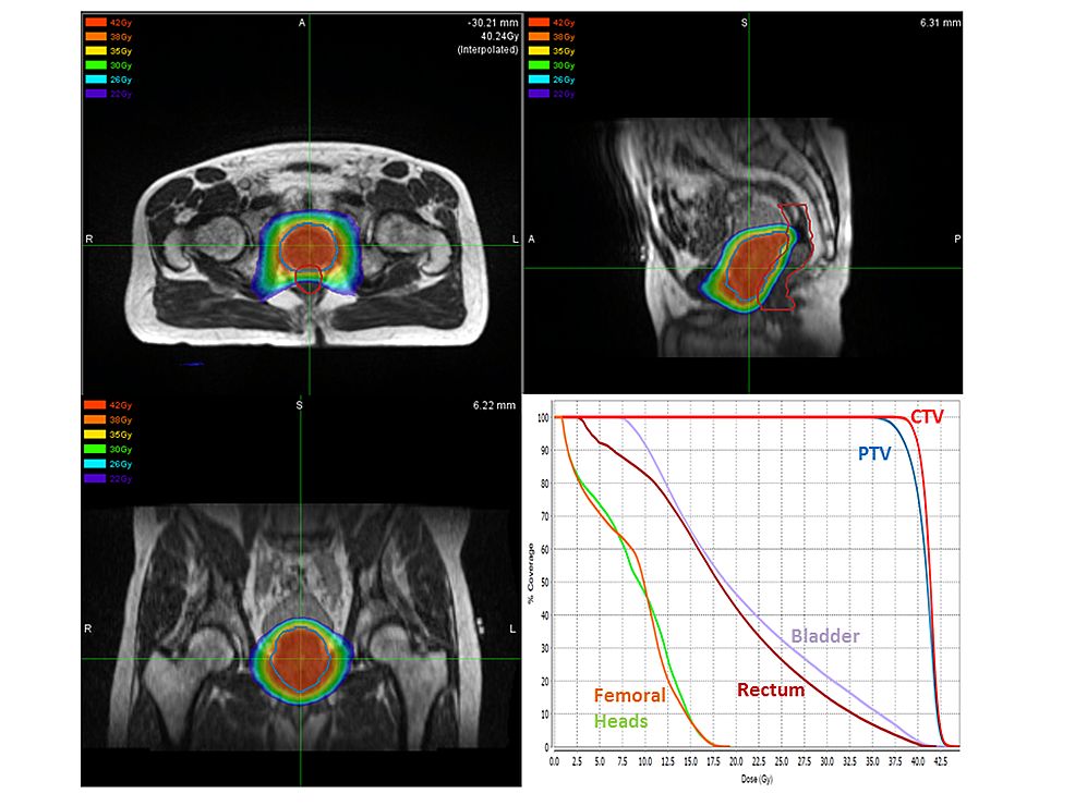 Sebastiano Finocchi Ghersi-1